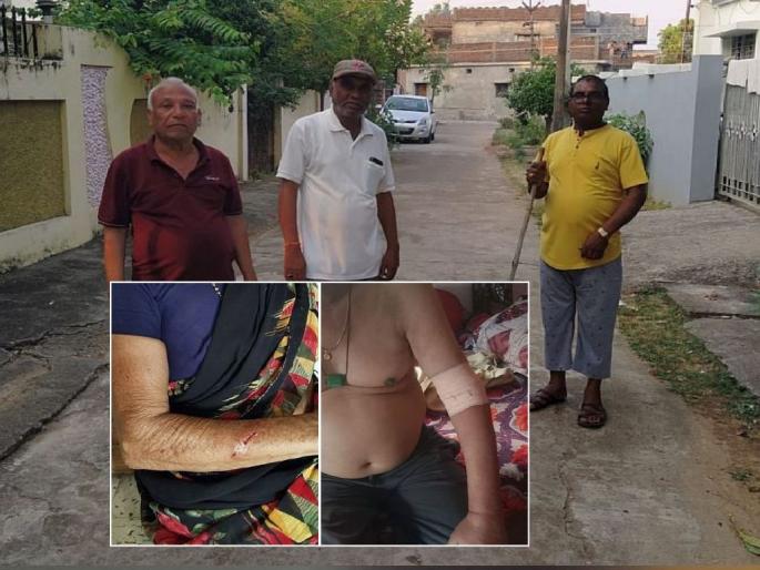 15 people were injured in attack by the wild monkey, it was difficult for the citizens to get out of their houses | भय संपेना! चवताळलेल्या माकडाने केले १५ जणांना जखमी! 15 people were injured in attack by the wild monkey, it was difficult for the citizens to get out of their houses | भय संपेना! चवताळलेल्या माकडाने केले १५ जणांना जखमी!