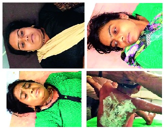 electric shock Four person serious | विजेच्या धक्क्याने चौघे गंभीर electric shock Four person serious | विजेच्या धक्क्याने चौघे गंभीर