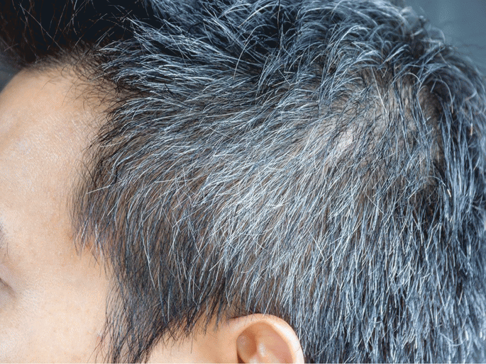 How to take care when you facing problem of hair fall and white hairs | वाढत्या वयात पांढरे आणि गळणारे केस लूक बिघडवतात? तर 'या' टिप्स वापरून केस नेहमी ठेवा चांगले How to take care when you facing problem of hair fall and white hairs | वाढत्या वयात पांढरे आणि गळणारे केस लूक बिघडवतात? तर 'या' टिप्स वापरून केस नेहमी ठेवा चांगले