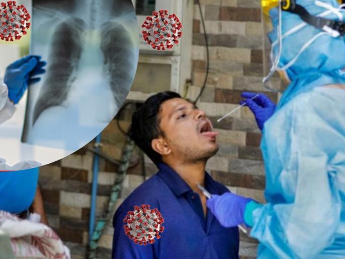 CoronaVirus : Recovered from covid 19 people are facing these major disease | काळजी वाढली! कोरोना संक्रमणातून बाहेर आल्यानंतरही पाठ सोडणार नाहीत 'या' समस्या CoronaVirus : Recovered from covid 19 people are facing these major disease | काळजी वाढली! कोरोना संक्रमणातून बाहेर आल्यानंतरही पाठ सोडणार नाहीत 'या' समस्या