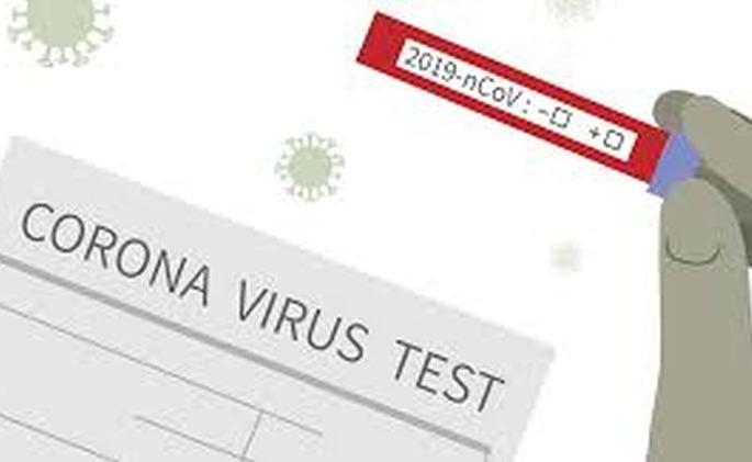 Both died during the day; Nine positives, 38 corona free | दिवसभरात दोघांचा मृत्यू; नऊ पॉझिटिव्ह, ३८ जण कोरोनामुक्त