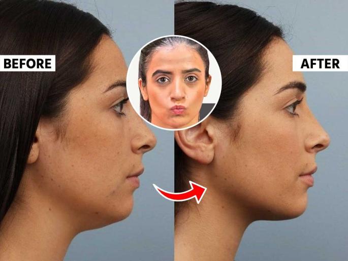 how to reduce fat on neck, 5 exercise to get perfect jaw line | गळ्यावरची चरबी वाढल्याने लठ्ठ दिसताय? ५ मिनिटांत ५ व्यायाम करा, मिळेल परफेक्ट जॉ लाईन