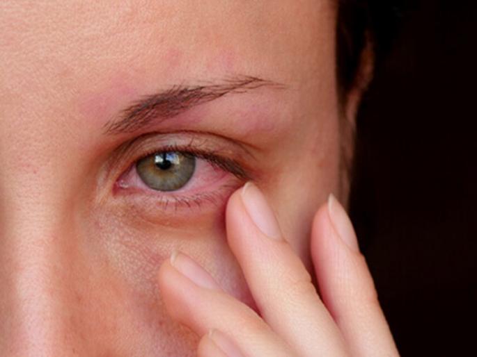 Maharashtra shocked by eye companion; As many as four and a half thousand people are infected in Pune as well | Eye Infection: डोळ्यांच्या साथीने महाराष्ट्र हैराण; पुण्यातही तब्बल साडेचार हजार जणांना लागण Maharashtra shocked by eye companion; As many as four and a half thousand people are infected in Pune as well | Eye Infection: डोळ्यांच्या साथीने महाराष्ट्र हैराण; पुण्यातही तब्बल साडेचार हजार जणांना लागण