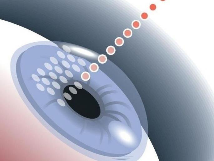 No eye surgery in two months at GMC! | ‘जीएमसी’त दोन महिन्यात एकही नेत्रशस्त्रक्रिया नाही! No eye surgery in two months at GMC! | ‘जीएमसी’त दोन महिन्यात एकही नेत्रशस्त्रक्रिया नाही!