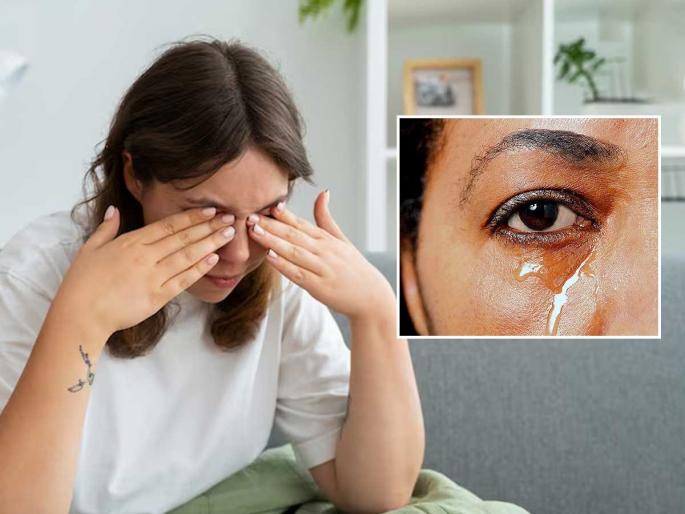 Watery eyes? Heat or something else? Know the common causes and try these remedies | सतत डोळ्यातून पाणी येते? उष्णता की आणखी काही? जाणून घ्या सामान्य कारणे आणि करा हे उपाय ... Watery eyes? Heat or something else? Know the common causes and try these remedies | सतत डोळ्यातून पाणी येते? उष्णता की आणखी काही? जाणून घ्या सामान्य कारणे आणि करा हे उपाय ...