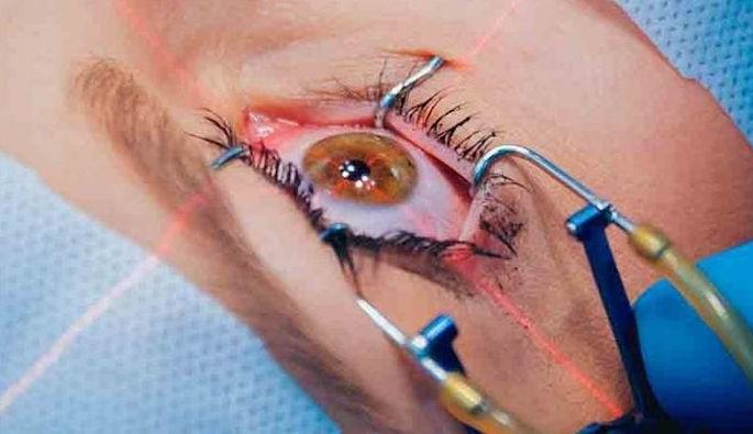 The eye surgery at the government hospital stopped | सरकारी रुग्णालयातील नेत्रशस्त्रक्रिया थांबल्या The eye surgery at the government hospital stopped | सरकारी रुग्णालयातील नेत्रशस्त्रक्रिया थांबल्या