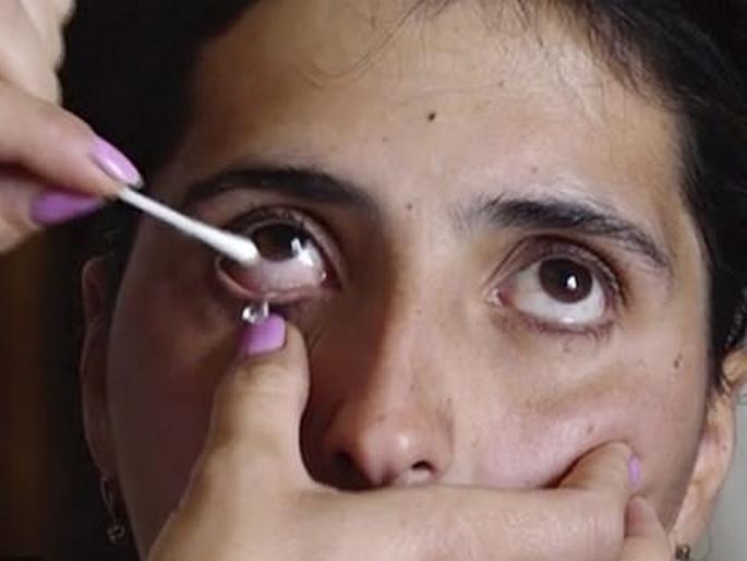 Shocking! Woman who cries crystal tears every day | महिलेच्या डोळ्यातून अश्रूंऐवजी निघतं असं काही, पाहून डॉक्टरही झाले हैराण! Shocking! Woman who cries crystal tears every day | महिलेच्या डोळ्यातून अश्रूंऐवजी निघतं असं काही, पाहून डॉक्टरही झाले हैराण!