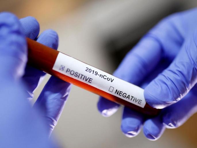 CoronaVirus 14 more death due to corona in maharashtra, 748 positive hrb | CoronaVirus राज्यात आणखी १४ बळी; ७४८ पॉझिटिव्ह CoronaVirus 14 more death due to corona in maharashtra, 748 positive hrb | CoronaVirus राज्यात आणखी १४ बळी; ७४८ पॉझिटिव्ह