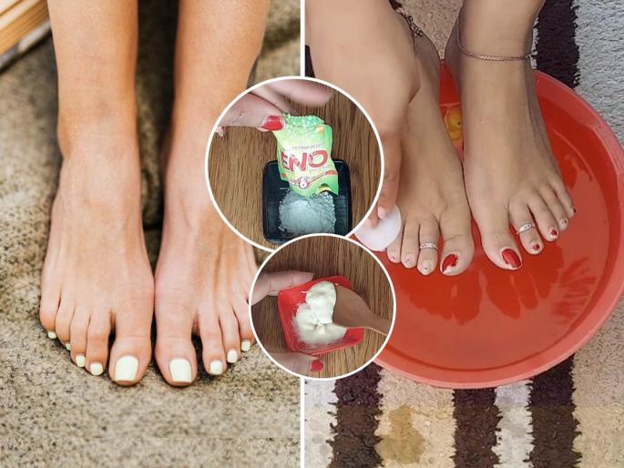Beauty Tips Easy Steps of Pedicure at Home : legs Got black ? Do this pedicure at home in 15 minutes; Feet will stay clean, look white... | घरच्याघरी १५ मिनिटांत पेडिक्युअर कसं करायचं? घ्या झटपट मेथड, पाय दिसतील स्वच्छ-सुंदर