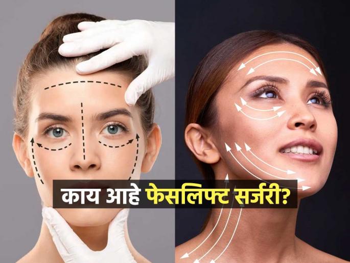 Facelift surgery trend is rising in young women, know the reason | तरुणींमध्ये प्रचंड वाढतेय फेसलिफ्ट सर्जरीची क्रेझ, कारण असं की तुमचा विश्वासच बसणार नाही.. Facelift surgery trend is rising in young women, know the reason | तरुणींमध्ये प्रचंड वाढतेय फेसलिफ्ट सर्जरीची क्रेझ, कारण असं की तुमचा विश्वासच बसणार नाही..