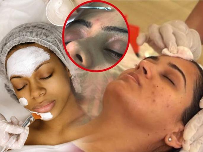 What's the difference between a facial and a cleanup? What you need for skin, 8 things you need to know. | फेशियल की क्लीनअप यात फरक काय? स्किनसाठी काय आवश्यक, 8 गोष्टी माहितीच हव्या..