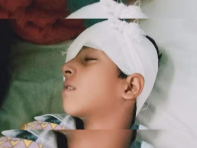 class teacher beaten 8 year student homework one eye lost jaipur | संतापजनक! शिक्षिकेने विद्यार्थ्याला जमिनीवर फेकलं, बेदम मारलं; डोळ्याला 12 टाके, दृष्टी गेली class teacher beaten 8 year student homework one eye lost jaipur | संतापजनक! शिक्षिकेने विद्यार्थ्याला जमिनीवर फेकलं, बेदम मारलं; डोळ्याला 12 टाके, दृष्टी गेली