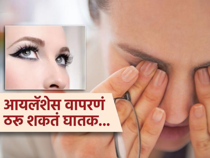 Doctor says fake eyelashes can cause blindness know the side effects | डोळ्यांचं सौंदर्य खुलवणाऱ्या आयलॅशेसमुळे येऊ शकतं अंधत्व, दृष्टी जाण्यापूर्वी व्हा सावध..