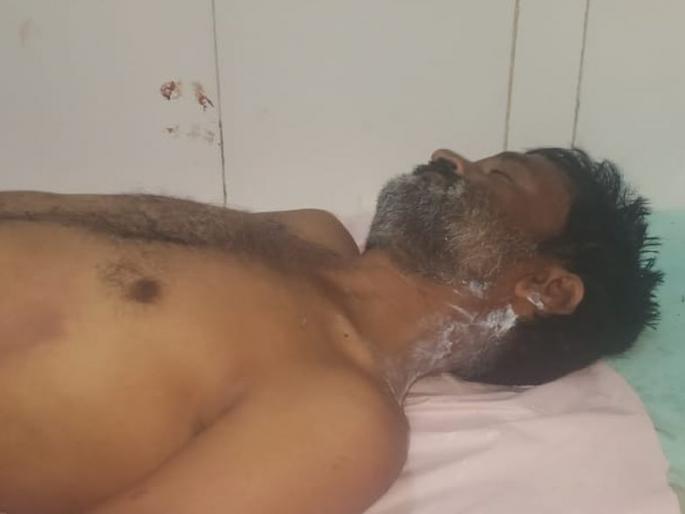 Two farmers injured in lightning strike at Khandala | खांदला येथे वीज पडून दोन शेतकरी जखमी Two farmers injured in lightning strike at Khandala | खांदला येथे वीज पडून दोन शेतकरी जखमी