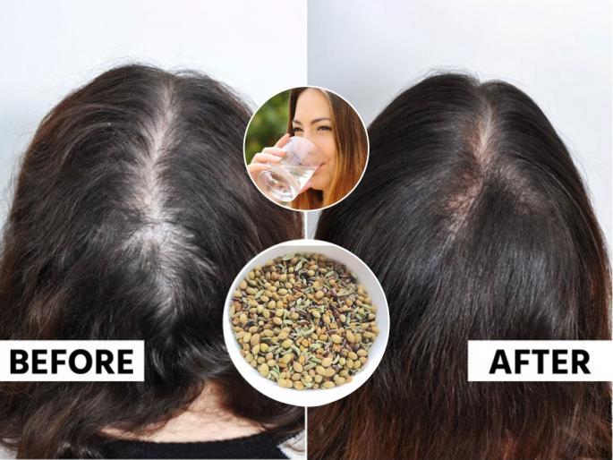 Hair fall solution at home Fast hair growth remedy home treatment Hair fall stop and regrowth tips | केसांची वाढ खुंटली-सारखे गळतात? रामबाण उपाय- केस वाढतील भरभर, दाटही होतील