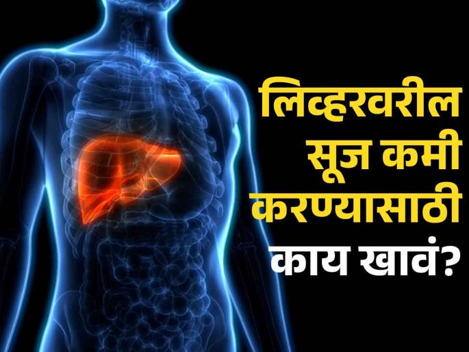 What foods help prevent and reverse fatty liver? | फॅटी लिव्हरची समस्या दूर करण्यासाठी काय खावं? जाणून घ्या काही सोपे उपाय! What foods help prevent and reverse fatty liver? | फॅटी लिव्हरची समस्या दूर करण्यासाठी काय खावं? जाणून घ्या काही सोपे उपाय!