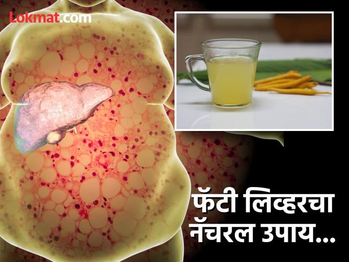 Nutritionist suggests natural kadha for fatty liver | लिव्हरवर जमा झालेली चरबी झरझर गळून पडेल, न्यूट्रिशनिस्टनं सांगितला जबरदस्त नॅचरल उपाय! Nutritionist suggests natural kadha for fatty liver | लिव्हरवर जमा झालेली चरबी झरझर गळून पडेल, न्यूट्रिशनिस्टनं सांगितला जबरदस्त नॅचरल उपाय!