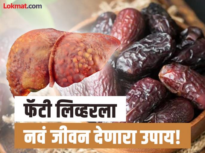 Ayurveda remedy that can treat liver damage due to alcohol according to Ayurveda doctor | दारूनं खराब झालेलं लिव्हर पुन्हा जागेवर आणण्याचा उपाय, आयुर्वेदाने मिळेल नवं जीवन! Ayurveda remedy that can treat liver damage due to alcohol according to Ayurveda doctor | दारूनं खराब झालेलं लिव्हर पुन्हा जागेवर आणण्याचा उपाय, आयुर्वेदाने मिळेल नवं जीवन!