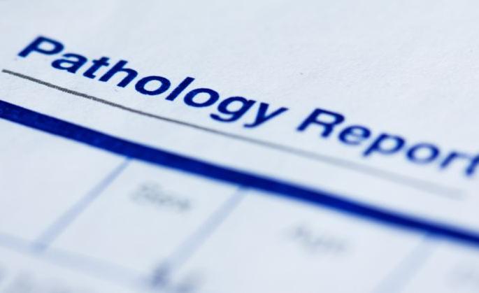 Be careful ..! Health check reports can be rigged | सावधान..! आरोग्य तपासणी अहवालाची होऊ शकते हेराफेरी