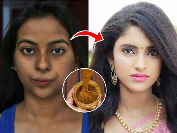 best home remedy to get rid of pimples during festivals how to use sugar for clear and glowing skin quick skin care tip to remove pimples before festival | सणावाराला चेहऱ्यावर पिंपल्स आले की चिडचिड होते? १ चमचा साखरेचा करा उपाय-चेहरा दिसेल नितळ स्वच्छ