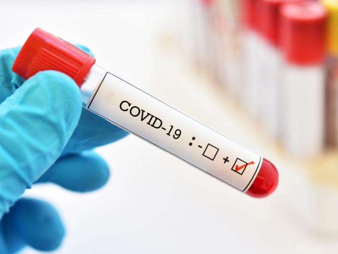 CoronaVirus Marathi news Shocking! Another MLA from Thane corona positive hrb | CoronaVirus in Thane धक्कादायक! ठाण्यातील आणखी एका आमदाराला कोरोनाची लागण   CoronaVirus Marathi news Shocking! Another MLA from Thane corona positive hrb | CoronaVirus in Thane धक्कादायक! ठाण्यातील आणखी एका आमदाराला कोरोनाची लागण