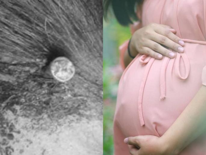 Crime News faith healer hammered nail into pregnant woman head so she would have baby boy | अंधश्रद्धेचा कळस! मुलाच्या हव्यासापोटी गर्भवती महिलेच्या डोक्यात ठोकला खिळा; झालं असं काही... Crime News faith healer hammered nail into pregnant woman head so she would have baby boy | अंधश्रद्धेचा कळस! मुलाच्या हव्यासापोटी गर्भवती महिलेच्या डोक्यात ठोकला खिळा; झालं असं काही...