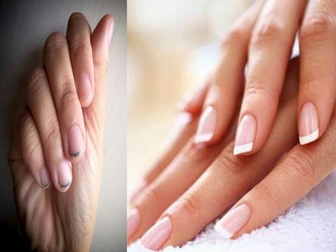 How to Clean Nails Properly : Easy nail cleaning tips | How to Clean Nails Properly : नखांमध्ये घाण अडकल्यानं काळपट मळलेले दिसतात; 5 सोप्या टिप्स, नखं नेहमी दिसतील स्वच्छ