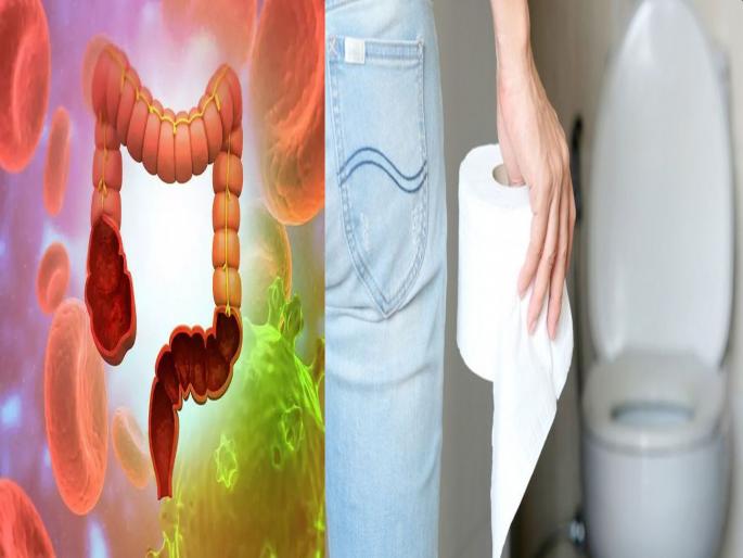 Corona may spread by toilet pipe too need to be extra careful while using toilet | सावधान! शौचालयाच्या माध्यमातून 'असा' होतोय कोरोनाचा प्रसार; संशोधनातून तज्ज्ञांचा खुलासा Corona may spread by toilet pipe too need to be extra careful while using toilet | सावधान! शौचालयाच्या माध्यमातून 'असा' होतोय कोरोनाचा प्रसार; संशोधनातून तज्ज्ञांचा खुलासा