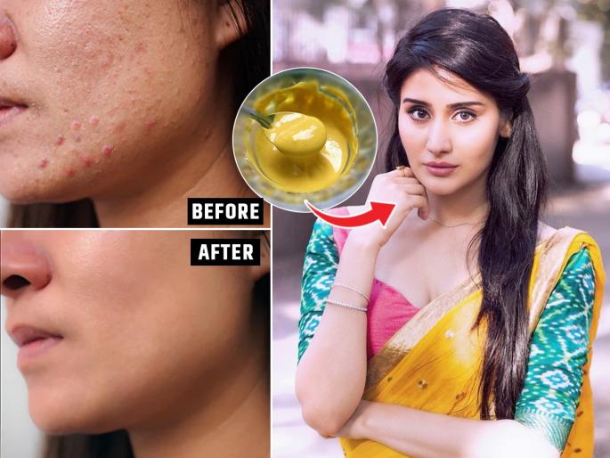 How to get Spotless Glowing Skin : Homemade Face Pack for Spotless Glowing Skin | १ चमचा तांदूळ, चिमूटभर मुगाची जादू; डागविरहीत, ग्लोईंग दिसेल डल, काळपट झालेला चेहरा