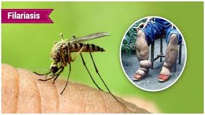 Akola district will move towards eradicating filariasis | अकोला जिल्ह्याची हत्तीरोग निर्मूलनाकडे वाटचाल