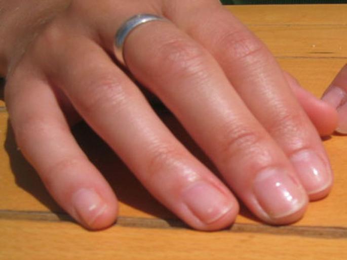 The woman gets trapped in the machine | मशिनमध्ये सापडून महिलेची बोटे निकामी