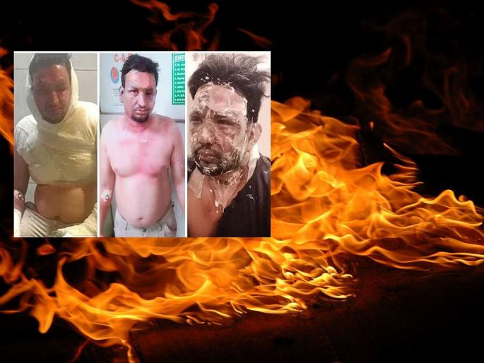 Crime: Holi fun or accident? Friends tried to burn their own friends, then... | Crime : होळीतली गंमत की घातपात? मित्रांनी आपल्याच मित्रांना जाळण्याचा केला प्रयत्न, त्यानंतर... Crime: Holi fun or accident? Friends tried to burn their own friends, then... | Crime : होळीतली गंमत की घातपात? मित्रांनी आपल्याच मित्रांना जाळण्याचा केला प्रयत्न, त्यानंतर...