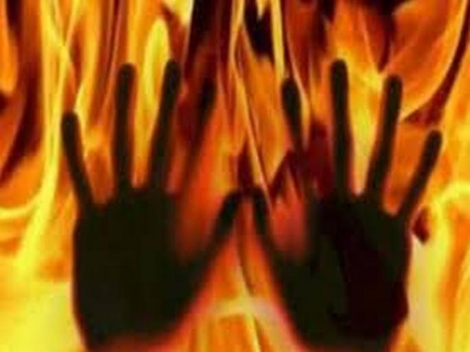 Cruel! The land mafia burned the woman alive, police admitted her to hospital | निर्दयी! भूमाफियांनी महिलेला जिवंत जाळले, पोलिसांनी केले रुग्णालयात दाखल Cruel! The land mafia burned the woman alive, police admitted her to hospital | निर्दयी! भूमाफियांनी महिलेला जिवंत जाळले, पोलिसांनी केले रुग्णालयात दाखल