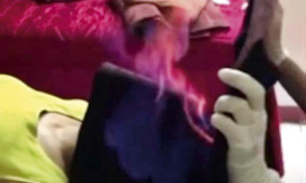 Fire Therapy - Vietnamese youth beauty trend going viral | फायर थेरपी - सुंदर दिसण्यासाठी व्हिएतनामी तारुण्याचा आगीशी खेळ! Fire Therapy - Vietnamese youth beauty trend going viral | फायर थेरपी - सुंदर दिसण्यासाठी व्हिएतनामी तारुण्याचा आगीशी खेळ!