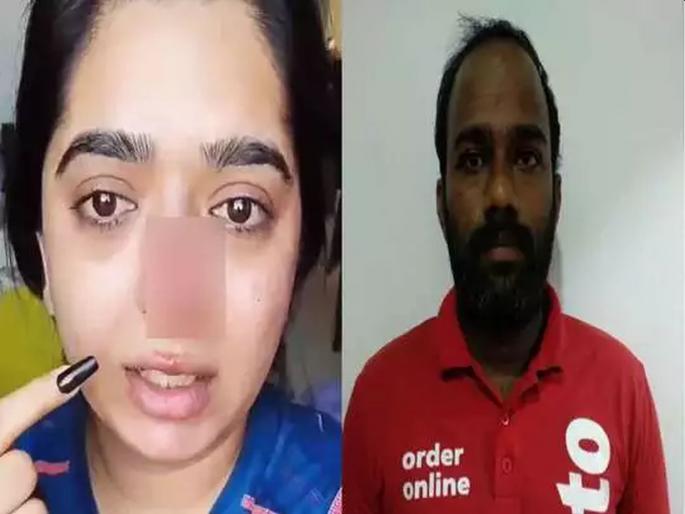 model hitesha chandranee self harm on her nose; Zomato Boy said story to police | झोमॅटो बॉयने मॉडेलच्या नाकावर बुक्का मारल्याप्रकरणी जे काही सांगितले, पोलिसही चक्रावले...