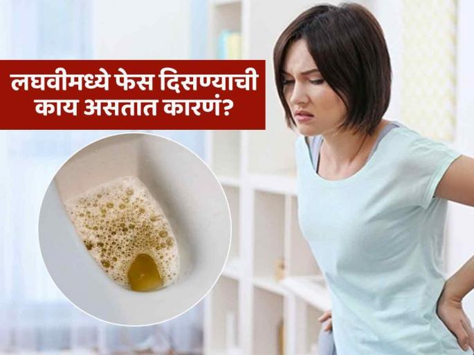 What does foam in urine indicate how much foam in urine is normal | विनाकारण येत नाही लघवीमध्ये फेस किंवा बुडबुडे, न्यूट्रिशनिस्टनं सांगितली कारणं आणि उपाय...