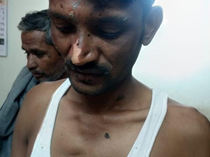 Four people were injured when a fire broke | पाचोरा तालुक्यातील नगरदेवळा येथे शेकोटीत स्फोट, चौघे जखमी Four people were injured when a fire broke | पाचोरा तालुक्यातील नगरदेवळा येथे शेकोटीत स्फोट, चौघे जखमी