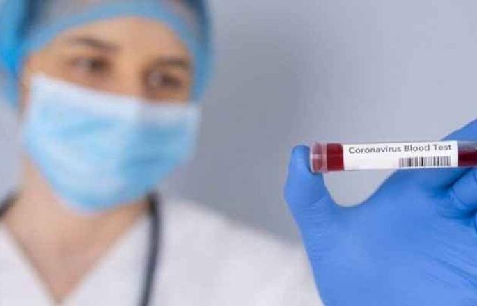 CoronaVirus: Patients are ‘corona’ free; But alarm bells forever! | CoronaVirus : रुग्ण ‘कोरोना’मुक्त होताहेत; पण धोक्याची घंटा कायमच! CoronaVirus: Patients are ‘corona’ free; But alarm bells forever! | CoronaVirus : रुग्ण ‘कोरोना’मुक्त होताहेत; पण धोक्याची घंटा कायमच!