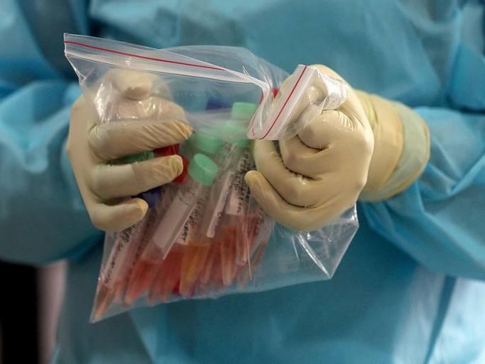 Doctor loses battle against CoronaVirus; The crowd opposed the burial hrb | CoronaVirus डॉक्टर कोरोनाविरोधातील लढाई हरला; मृतदेह दफन करण्यास जमावाने विरोध केला