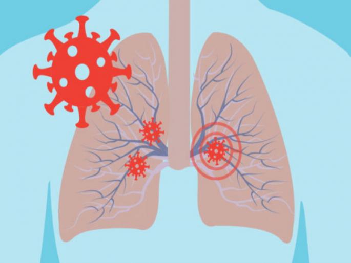 Corona's new revelation! At least five to ten thousand viruses can easily live in the lungs | कोरोनाचा संदर्भात नवा खुलासा! फुफ्फुसात सहज राहू शकतात किमान पाच ते दहा हजार विषाणू Corona's new revelation! At least five to ten thousand viruses can easily live in the lungs | कोरोनाचा संदर्भात नवा खुलासा! फुफ्फुसात सहज राहू शकतात किमान पाच ते दहा हजार विषाणू
