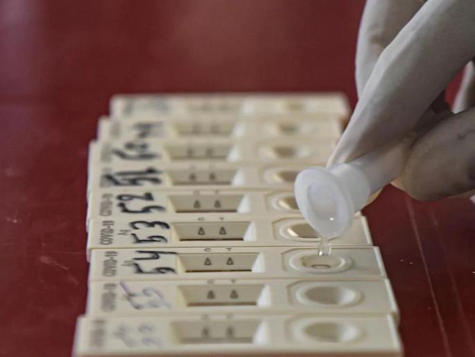 Corona report came positive; female doctor, nurse beaten by Youth | कोरोना रिपोर्ट पॉझिटिव्ह आला; तरुणाची महिला डॉक्टर, नर्सना मारहाण Corona report came positive; female doctor, nurse beaten by Youth | कोरोना रिपोर्ट पॉझिटिव्ह आला; तरुणाची महिला डॉक्टर, नर्सना मारहाण