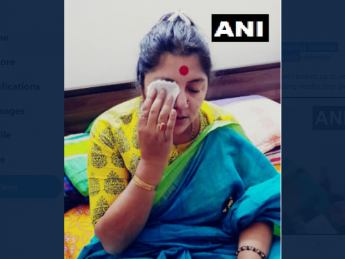 BJP's Locket Chatterjee alleges that colours containing 'harmful chemicals' was thrown on her face | भाजपाच्या महिला उमेदवारावर फेकला विषारी रंग; प्रकृती चिंताजनक, TMC वर केला गंभीर आरोप BJP's Locket Chatterjee alleges that colours containing 'harmful chemicals' was thrown on her face | भाजपाच्या महिला उमेदवारावर फेकला विषारी रंग; प्रकृती चिंताजनक, TMC वर केला गंभीर आरोप