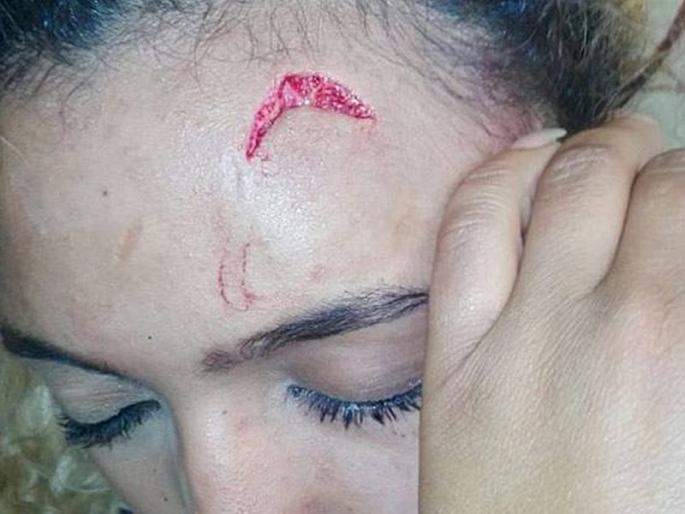 first lady of zimbabwe allegedly assaulted a model who partied with her sons | मुलासोबत हॉटेलमध्ये दिसली मॉडेल, राष्ट्रपतींच्या पत्नीने बदडलं first lady of zimbabwe allegedly assaulted a model who partied with her sons | मुलासोबत हॉटेलमध्ये दिसली मॉडेल, राष्ट्रपतींच्या पत्नीने बदडलं
