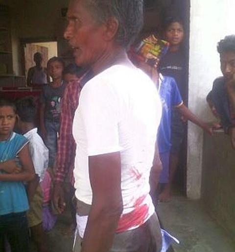 One injured in an unknown motorcycle firing | अज्ञात मोटरसायकलस्वारांच्या गोळीबारात एक जखमी