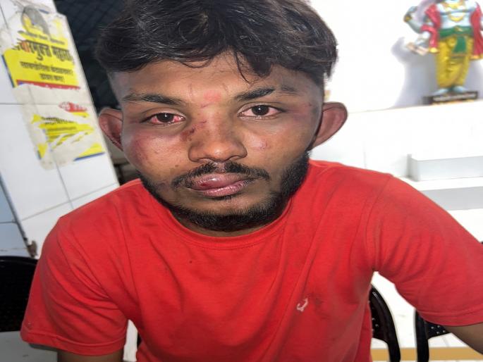 In Kalyan, a young man was abducted and beaten due to an old dispute | कल्याणमध्ये जुन्या वादातून तरुणाचे अपहरण करत बेदम मारहाण In Kalyan, a young man was abducted and beaten due to an old dispute | कल्याणमध्ये जुन्या वादातून तरुणाचे अपहरण करत बेदम मारहाण