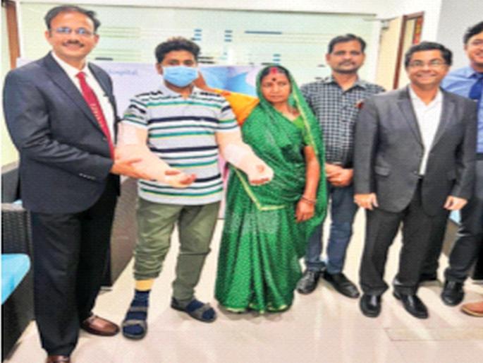 Surat brain dead donor 'hands' to Ujjain youth; Successful hand transplant in Mumbai | सुरतच्या मेंदूमृत दात्याचे उज्जैनच्या युवकाला ‘हात’; मुंबईत हाताचे यशस्वी प्रत्यारोपण Surat brain dead donor 'hands' to Ujjain youth; Successful hand transplant in Mumbai | सुरतच्या मेंदूमृत दात्याचे उज्जैनच्या युवकाला ‘हात’; मुंबईत हाताचे यशस्वी प्रत्यारोपण