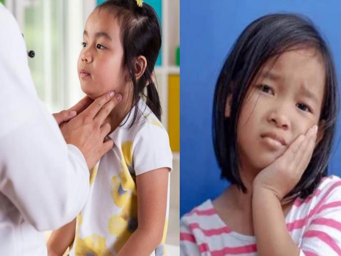 Galgund mumps increased in other parts of the state including Mumbai; What care? | ‘गालगुंड’ का होते? अशा वेळेस लहान मुलांची कशी काळजी घ्यावी, जाणून घ्या सविस्तर Galgund mumps increased in other parts of the state including Mumbai; What care? | ‘गालगुंड’ का होते? अशा वेळेस लहान मुलांची कशी काळजी घ्यावी, जाणून घ्या सविस्तर