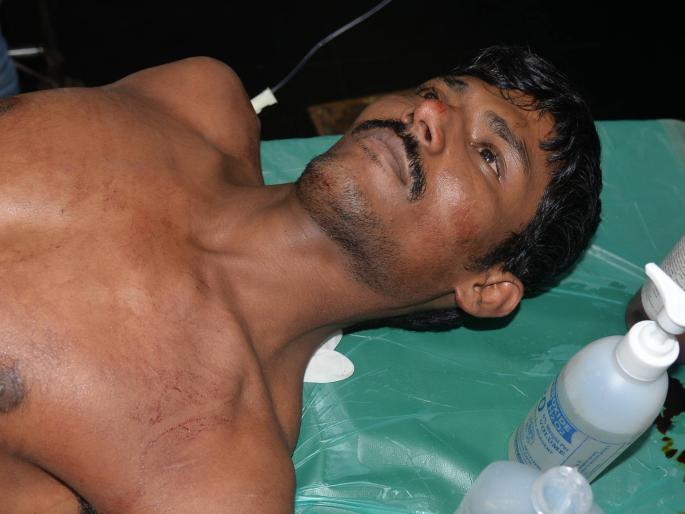 Prisoner's Suicide Attempted From Depression in Kalamba Prison | कळंबा कारागृहात नैराश्यातून कैद्याचा आत्महत्येचा प्रयत्न Prisoner's Suicide Attempted From Depression in Kalamba Prison | कळंबा कारागृहात नैराश्यातून कैद्याचा आत्महत्येचा प्रयत्न