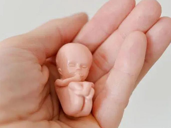 Ladies! Are you aware of the Gestational Diagnosis Prevention Act? | महिलांनो! गर्भलिंग निदान प्रतिबंध कायदा ठाऊक आहे का? Ladies! Are you aware of the Gestational Diagnosis Prevention Act? | महिलांनो! गर्भलिंग निदान प्रतिबंध कायदा ठाऊक आहे का?