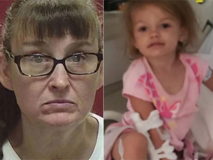 This 2 year old girl could lose her feet after step grandma dipped toddlers feet into boiling water | रागात आजीने नातीचा पाय टाकला उकळत्या पाण्यात; चिमुरडी होऊ शकते अधू This 2 year old girl could lose her feet after step grandma dipped toddlers feet into boiling water | रागात आजीने नातीचा पाय टाकला उकळत्या पाण्यात; चिमुरडी होऊ शकते अधू